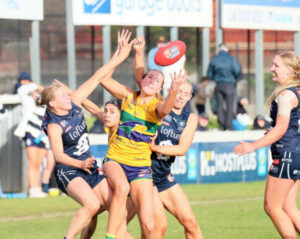 Ruby and the Eagles bridesmaids